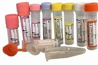 Metropolitana della raccolta del gel del siero di sierologia della metropolitana del laboratorio di Sst per tiraggio del sangue fornitore