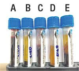 Metropolitana blu coagulata del sangue del Cbc  della cima, fiale della raccolta del campione di sangue fornitore