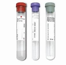 Metropolitana della raccolta del gel del siero di sierologia della metropolitana del laboratorio di Sst per tiraggio del sangue fornitore